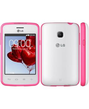 LG L30 - Замена корпуса